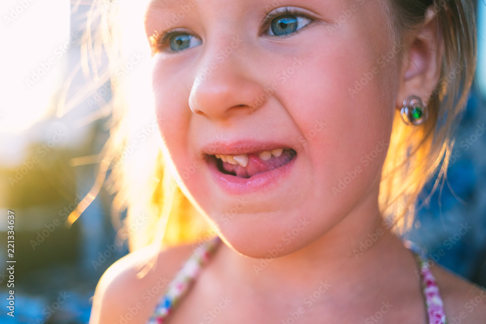 Obraz premium Portrait of a little girl with an outstretched milk tooth