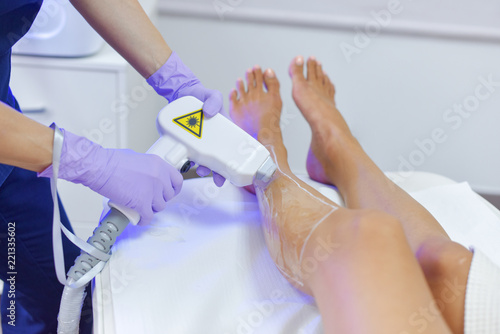 Epilation with a diode laser  hair removal with laser