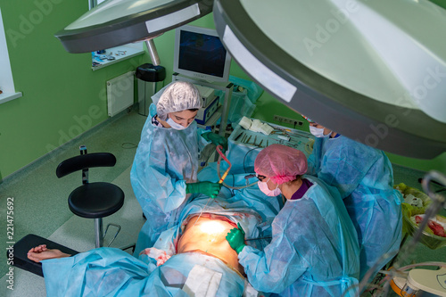 cosmetic liposuction surgery in actual operating room, group of surgeons working with cannula