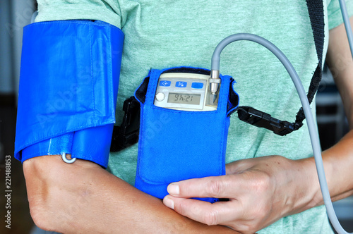 Woman wearing holter monitor device for daily monitoring of an electrocardiogram. Health care and disease prevention.