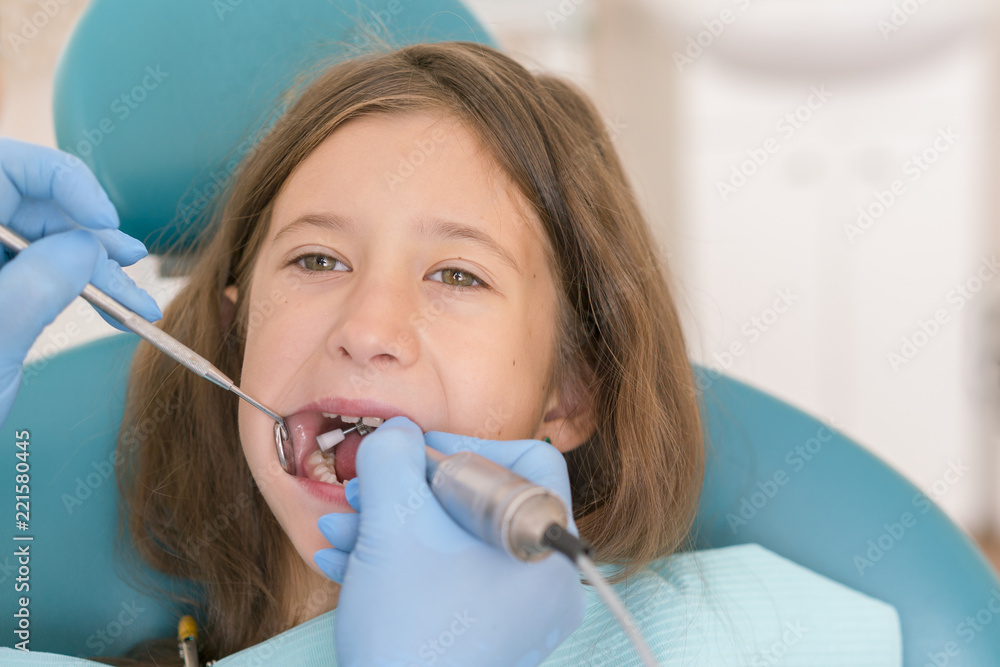 Young girl at dentist, dental treatment. Macro close up of young child