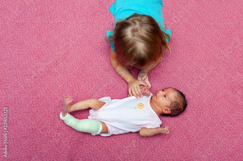 Bird Eye View of Older Sister Comforting Newborn Baby Wearing a Cast to Correct Her Clubfoot photo