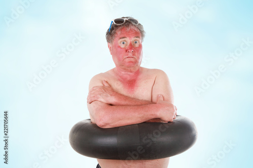 Sunburned man with sunglasses lines and inner tube