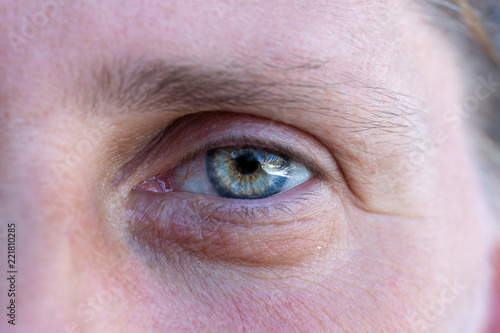 Woman's eye closeup