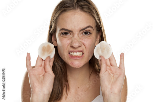 young disgusted girl showing a dirty cotton pads on white backgeound