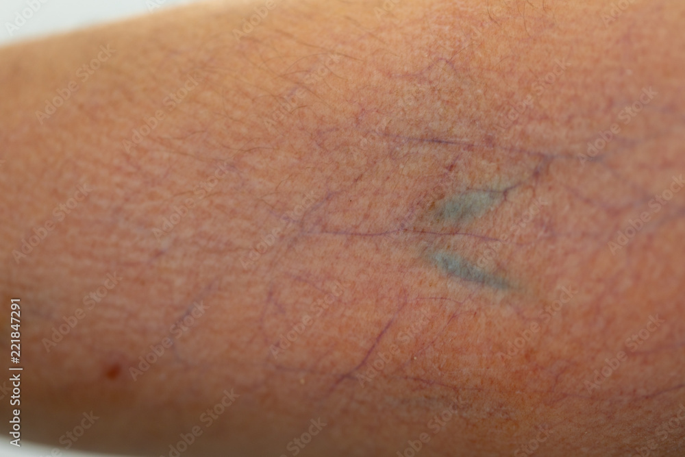Fototapeta premium A physical of tissue, nerves, tendons at hand.