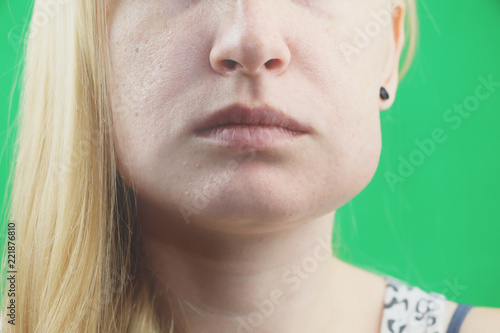 Canvastavla Teeth Problem