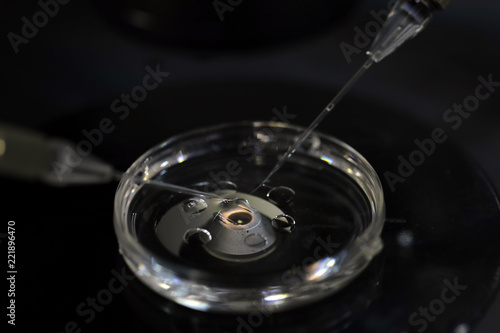 This images shows the process of "IVF".  After obtaining the mother's ovum and the sperm of father,the technician in the lab separates the mother’s ovum and inserts the sperm into it.
