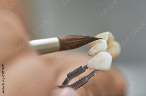Closeup of dental technician putting ceramic to dental implants in his laboratory.