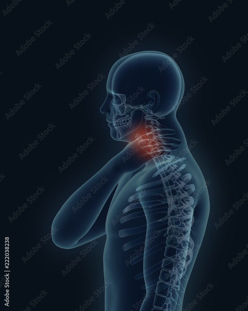 Medical image of human X-ray scan with sore throat 3d render Medical image of human X-ray scan with sore throat 3d render