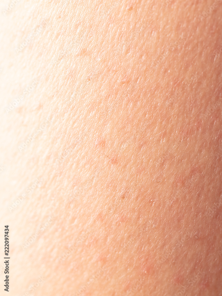 Girl's skin after depilation as a background
