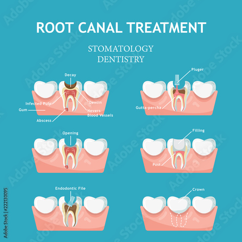 Dental concept. Dentistry and stomatology poster. Cavities and chipped