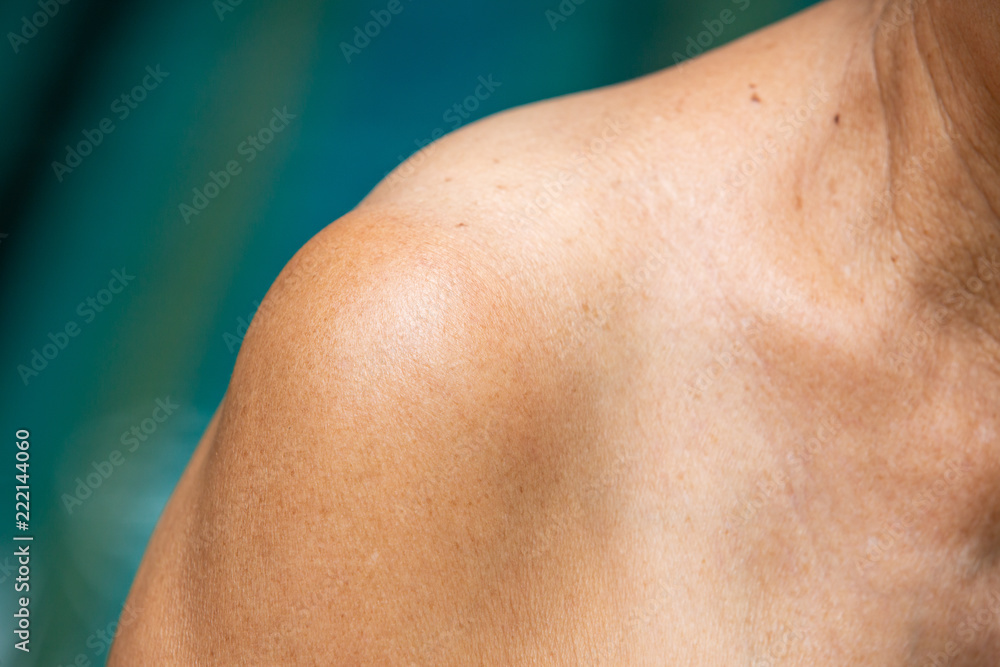 Senior woman's shoulder, Close up, Blue swimming pool background, Body concept Senior woman's shoulder, Close up, Blue swimming pool background, Body concept