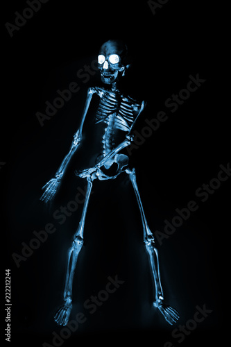 Dancing Skeletons X ray