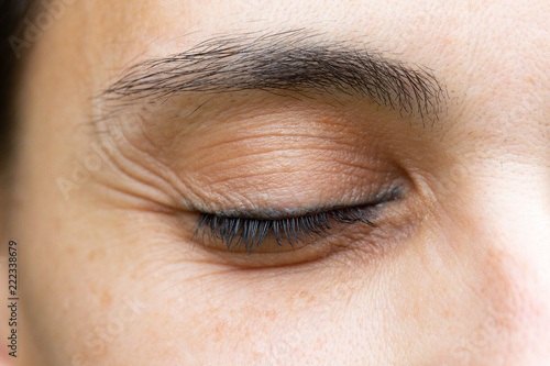 Wrinkles on close eye