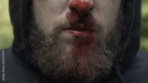 Close portrait of unrecognizable man with beaten nose with blood at camera