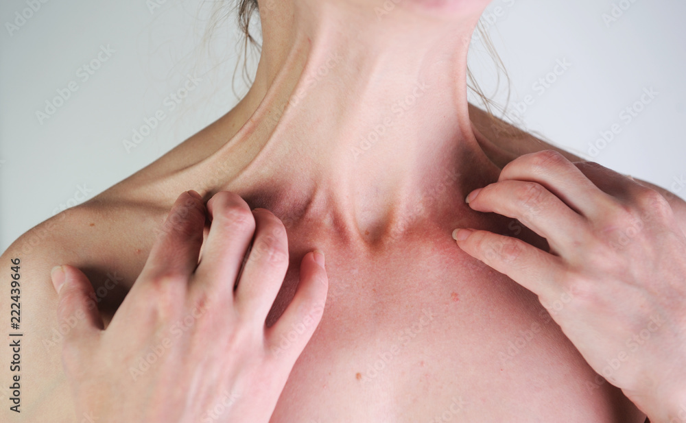 Woman has itch on gray background Woman has itch on gray background