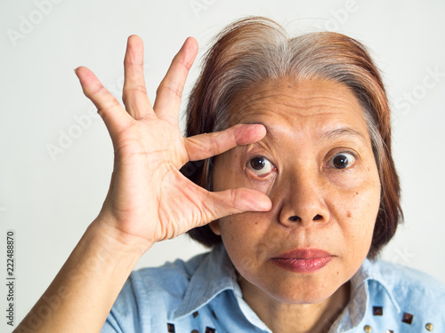 retirement elderly old ages asia women have eyes pain cataract lasik eyes surgery treatment flu fever dizzy dull stabbing headaches throbbing solutions problem systems