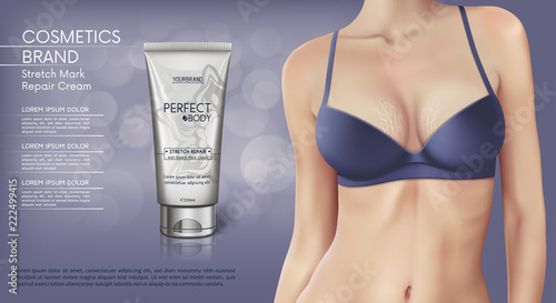 Web banner design of Stretch mark removal cream. Concept vector illustration of skin care and with woman with stretch marks on breast
