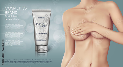 Web banner design of Stretch mark removal cream. Concept vector illustration of skin care and with woman with stretch marks on breast photo