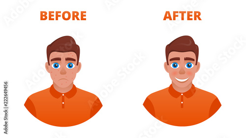 Acne treatment concept