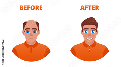 Hair growth concept