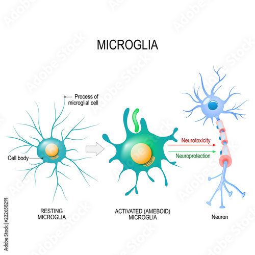 Activation of a microglial cell. photo