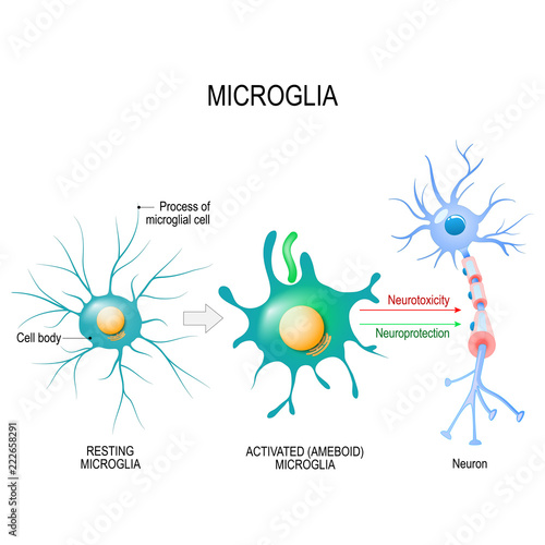 Activation of a microglial cell.