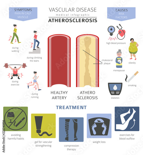 Vascular diseases. Atherosclerosis symptoms, treatment icon set. Medical infographic design