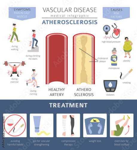 Vascular diseases. Atherosclerosis symptoms, treatment icon set. Medical infographic design