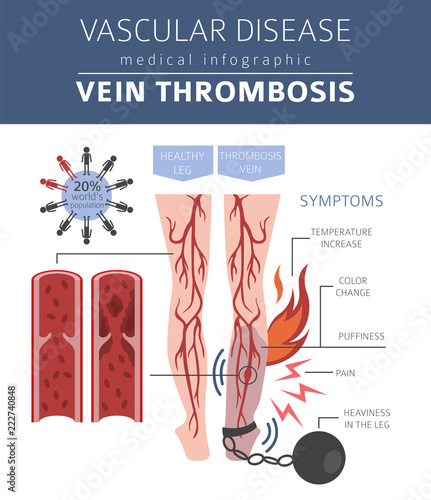 Vascular diseases. Vein thrombosis symptoms, treatment icon set. Medical infographic design