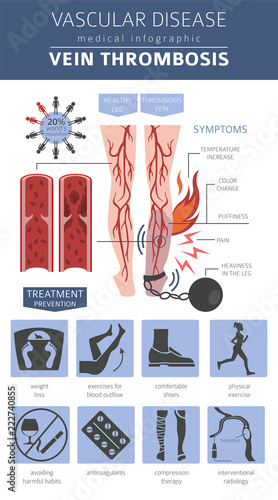 Vascular diseases. Vein thrombosis symptoms, treatment icon set. Medical infographic design