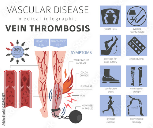 Vascular diseases. Vein thrombosis symptoms, treatment icon set. Medical infographic design