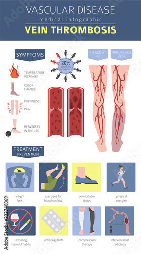 Vascular diseases. Vein thrombosis symptoms, treatment icon set. Medical infographic design