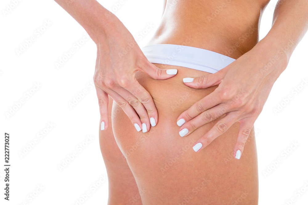 Checking cellulite, woman hip, closeup of beautiful female body legs Checking cellulite, woman hip, closeup of beautiful female body legs