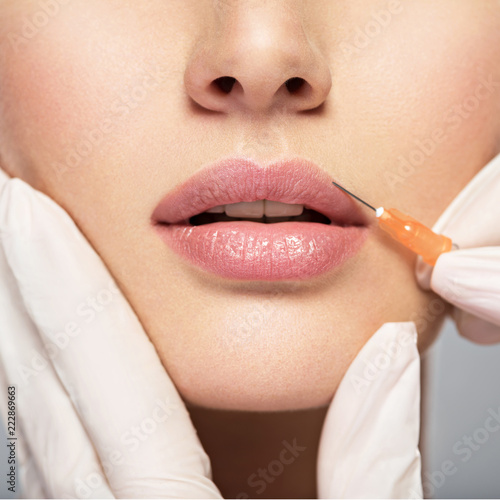 young woman gets botox injection in her lips photo