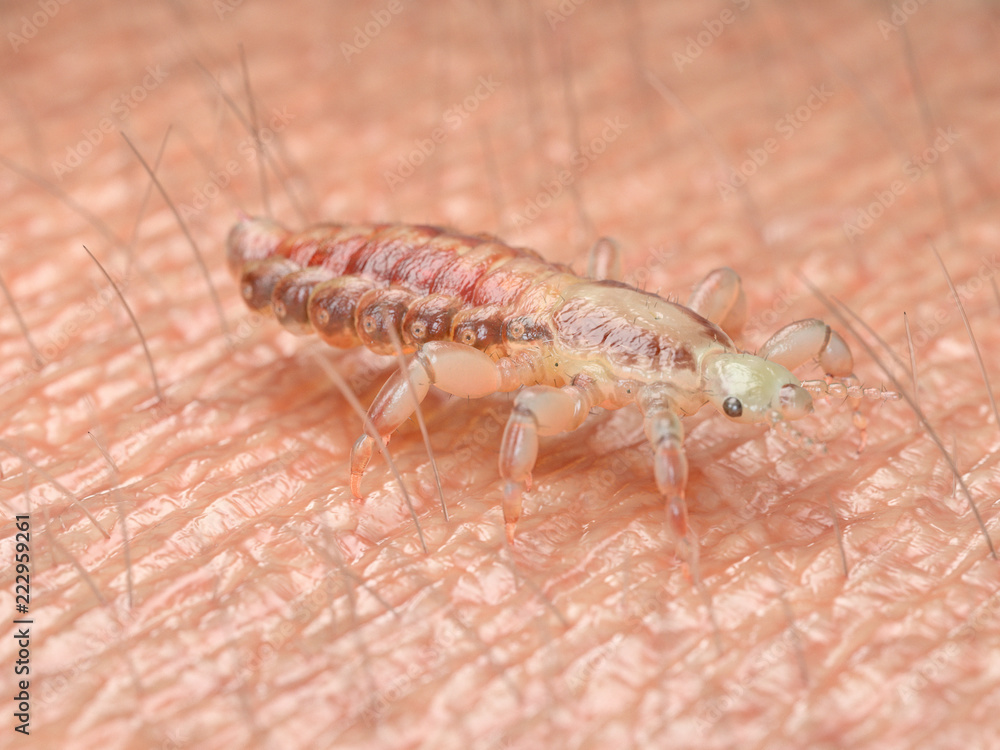 3d rendered medically accurate illustration of a head louse 3d rendered medically accurate illustration of a head louse