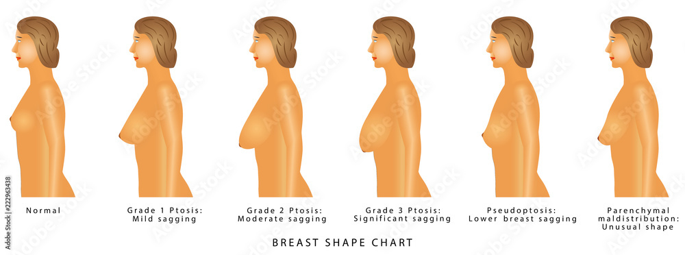 Breast Shape chart Векторный объект Stock