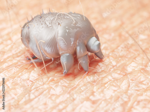 Photos 3d rendered medically accurate illustration of a scabies mite on human skin