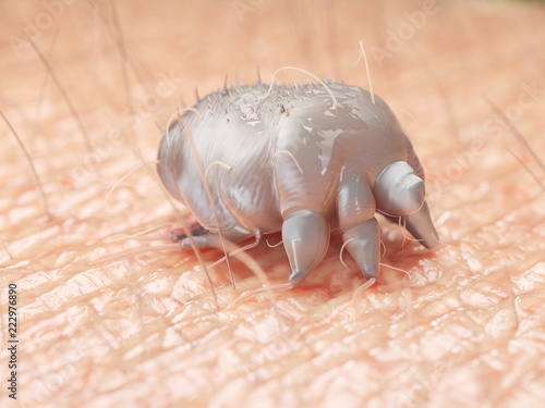 3d rendered medically accurate illustration of a scabies mite on human skin photo