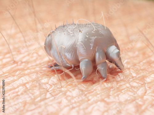 Photos 3d rendered medically accurate illustration of a scabies mite on human skin