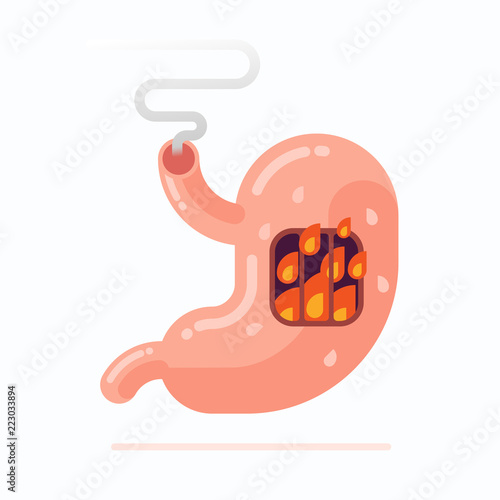 Flat vector Illustration of human stomach burning, heartburn disease concept