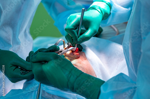 Surgeon and his assistant performing cosmetic surgery on nose in hospital operating room. Nose reshaping, augmentation. Rhinoplasty.