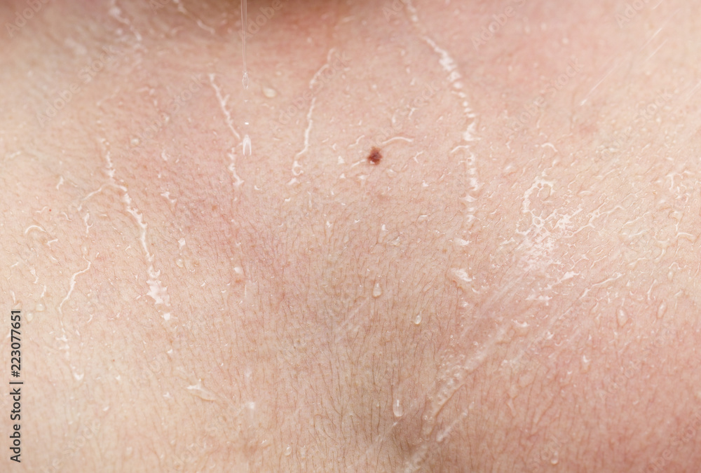 Fototapeta premium Wet human skin with a drop of water