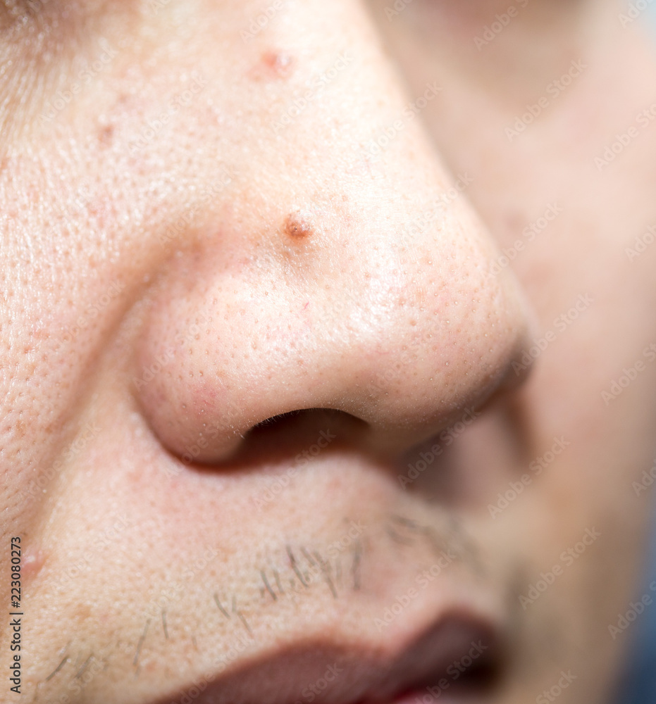 nose close up man nose close up man
