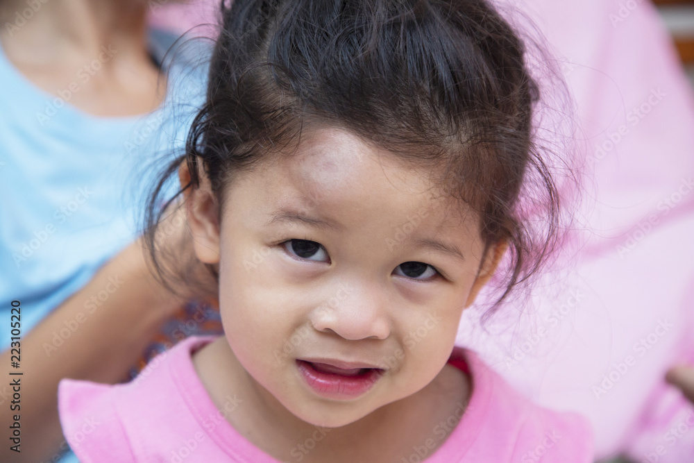 Asian little girl gets an accident on her head, Bump on the head. Asian little girl gets an accident on her head, Bump on the head.