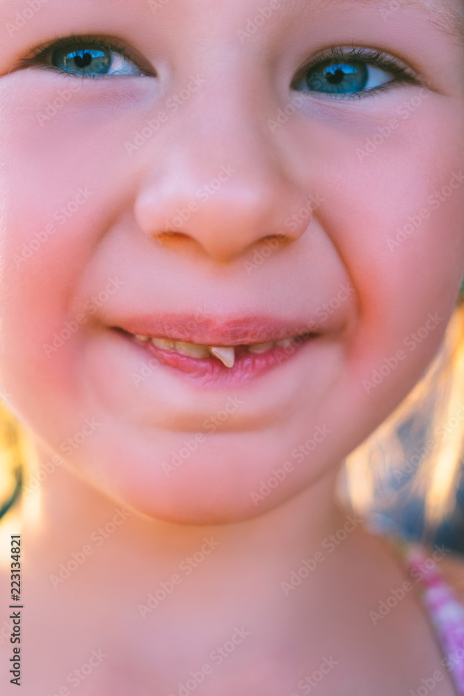 Fototapeta premium Portrait of a little girl with an outstretched milk tooth