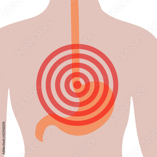 Stomach ache in Human body.  Abdominal pain.  Heartburn.  Disoder of digestive system