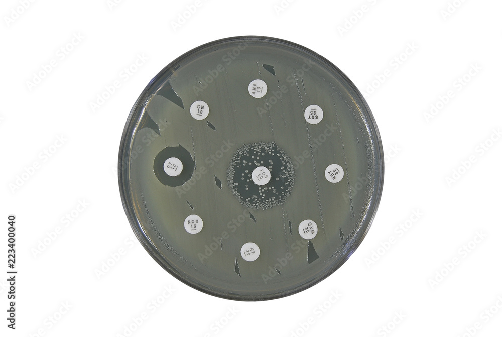 antimicrobial susceptibility test antimicrobial susceptibility test