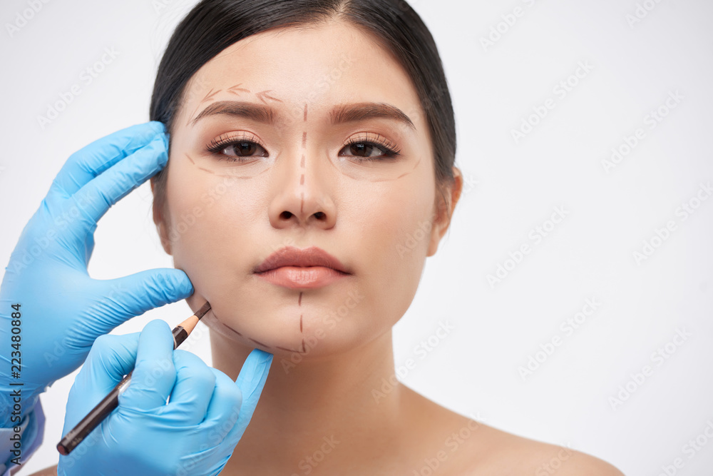 Cosmetic surgeon drawing lines on face of young beautiful woman
